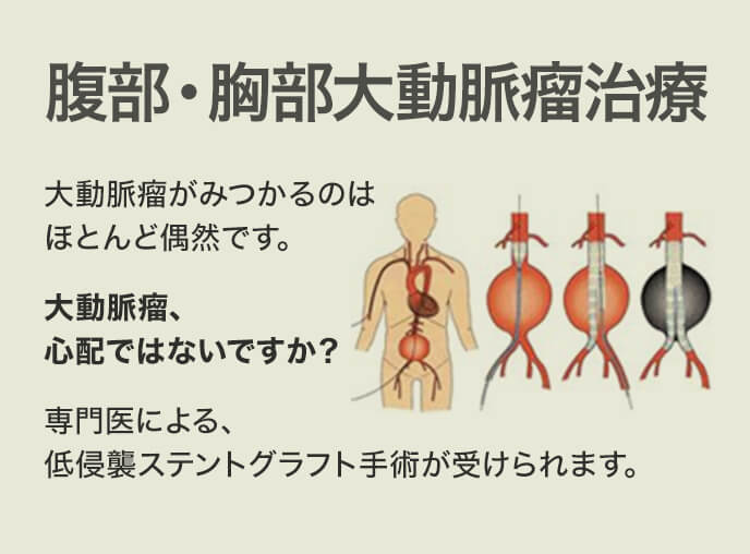 腹部・胸部 大動脈瘤治療